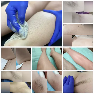 Depilacja/Depilacja Pastą Cukrową Ostrów Wielkopolski